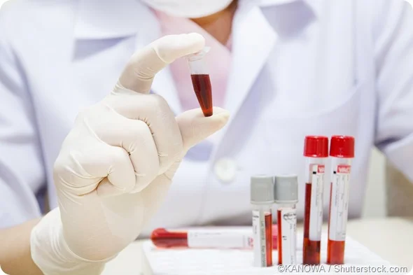 Clinical Biochemistry Tests